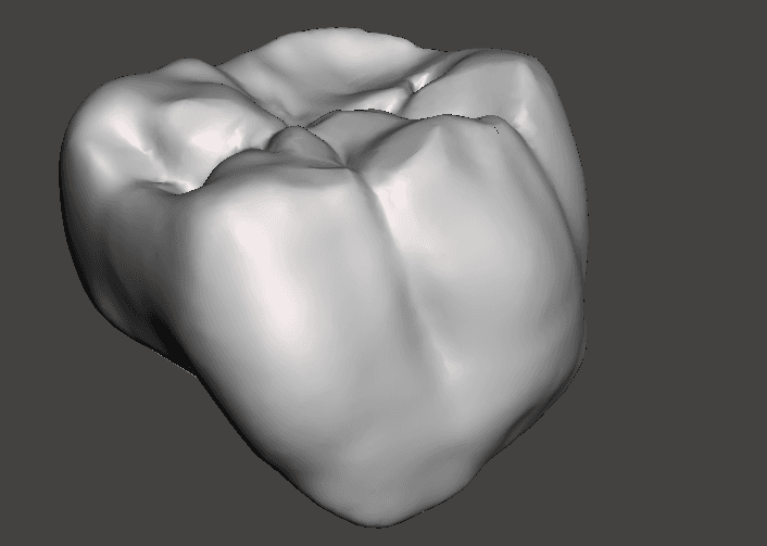Digital Smile Design